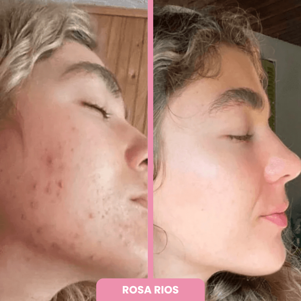 OFERTA 2x1 + BROCHA REGALO | Máscara de Colágeno Coreana 🇰🇷